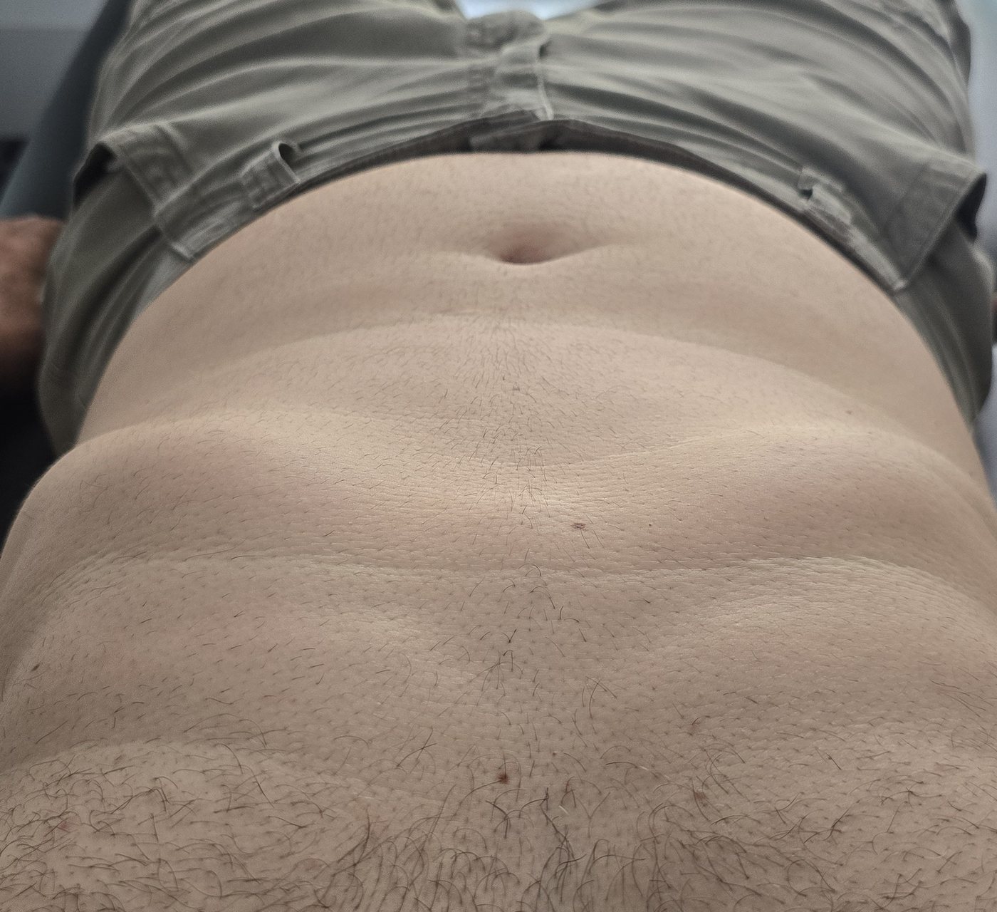 A person lying on their back on a treatment table, viewed from the feet, with the lower edge of the rib cage visibly raised and open.